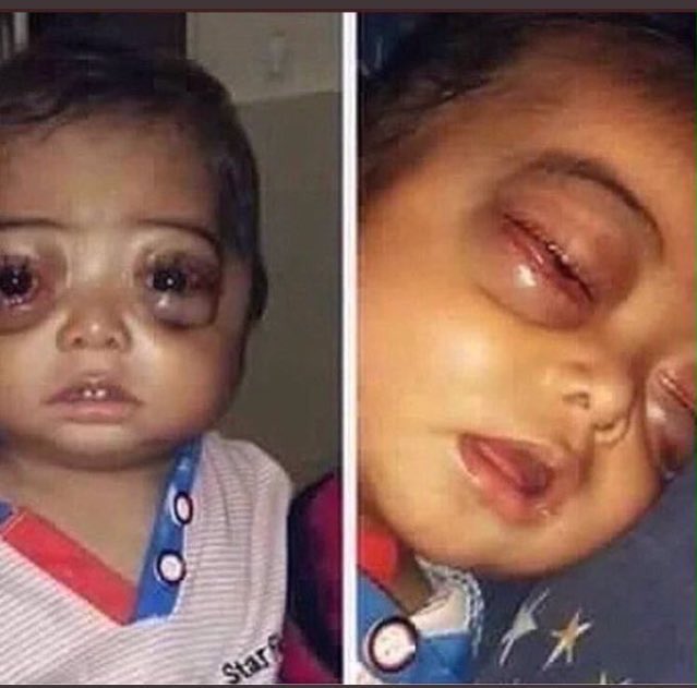 طفل مصاب بالسرطان .. ماياخذ من وقتك شي لو سويت رتويت ودعيت له وخليت غيرك يدعي له بالشفاء
"
الله يشافيه يارب.
.
.
.
#أطفال_شي_إن
#شي_حلو_بحرف_م
#افضل_سناب_بجوالك
#هدف_ماتنساه 
#تعليق_الواتساب