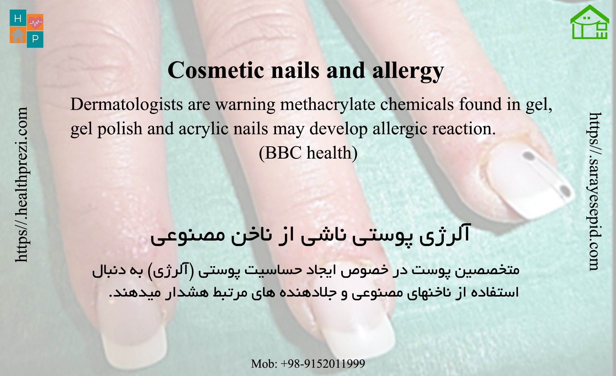 Top more than 137 methacrylate nail polish super hot songngunhatanh