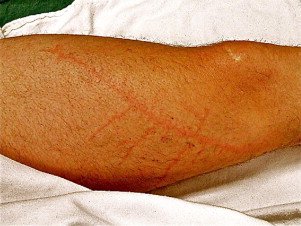 AnnalsofEM tweet media