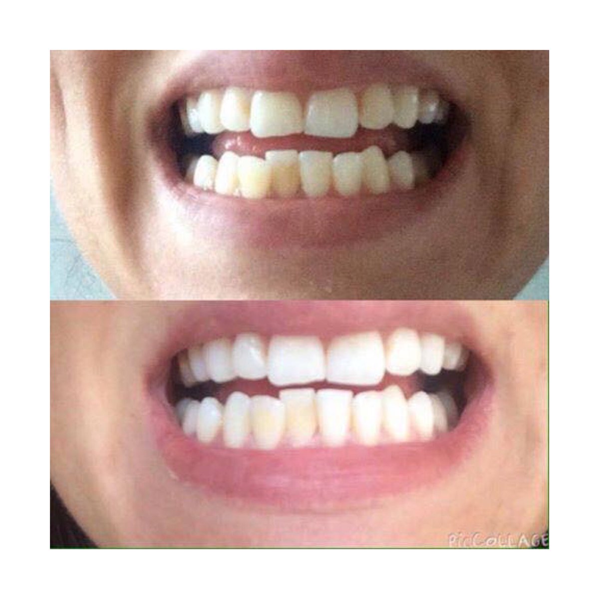DaniD8719's tweet photo. Who would like the chance to get a free whitening toothpaste! https://t.co/i5JDWXVfnL