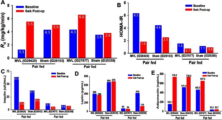 SOARD_JOURNAL's tweet photo. Mesenteric visceral lipectomy using tissue liquefaction technology reverses insulin resistance and causes weight loss in baboons #soard #soard18 #bariatricsurgery @asmbs https://t.co/OyXwwYSr5k https://t.co/1PKjbQkgra