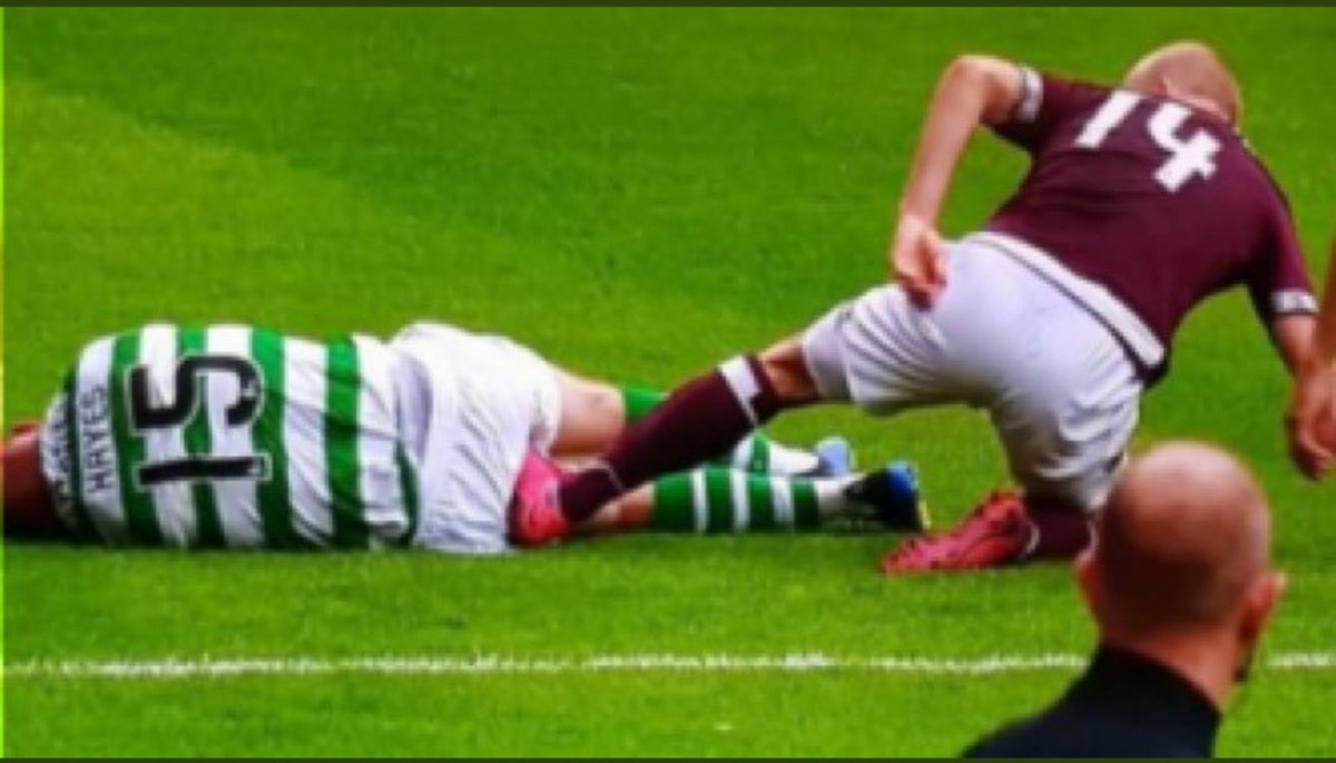 whyteo7's tweet image. One of these gets you a 3 match ban...the rest is fair game @ScottishFA complete clowns