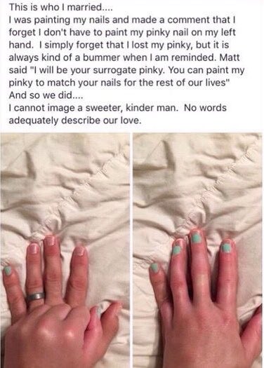 Photo and story of a married man who always paints his left pinky like his wife’s to be her “surrogate” since she lost her pinky in an accident