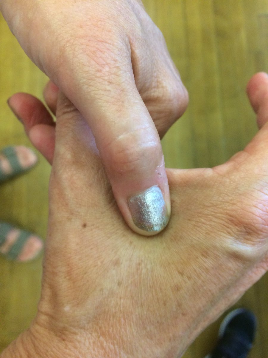 mdcarpenter's tweet photo. Day 5 #20DayTwitterChallenge #BFairfax 6th grade students massage their hands as a way to reduce anxiety and stress. https://t.co/2vQ3ovXnkP