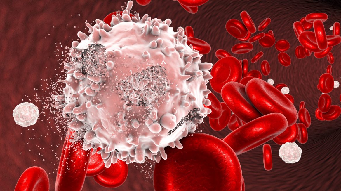 ICRFTORONTO's tweet photo. Prof. Yinon Ben-Neriah + his team at the Hebrew University of Jerusalem’s Faculty of Medicine developed a new biological drug showing a cure rate of 50% for lab mice with acute myeloid leukemia — Click to read more https://t.co/w2DlLduXMa https://t.co/Qe3WviHgfN