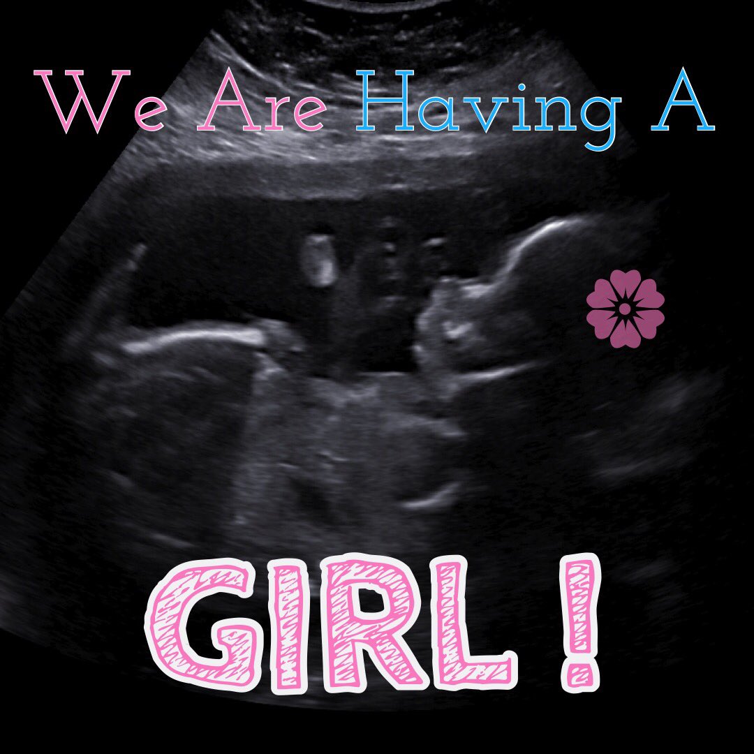 murfizzle's tweet photo. Yay!!! We are having a girl!!! 💕🎀 Bring on all the pink, glitter, and bows!!! #babygirl #pink #glitter #bows 🎀💕 RT @Codfiddle: WE ARE HAVING A GIRL!!! https://t.co/E3ftPOu3Tq