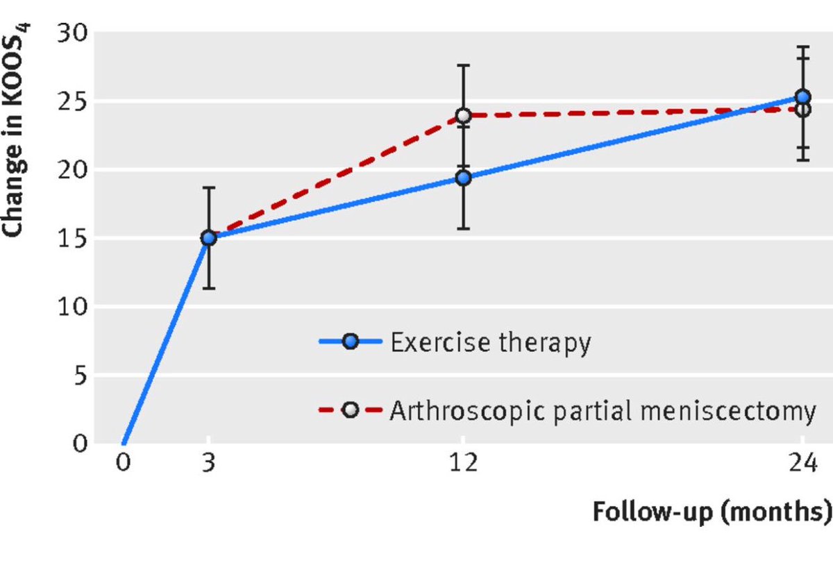AMP_Physio's tweet photo. 🚴🏻‍♀️ Mgmt of Meniscus Tears 

1️⃣ Exercise v meniscectomy: no difference
https://t.co/EAfj0AkNw0

2️⃣ Surgery v placebo surgery: no difference
https://t.co/FqWpmXCCvP

3️⃣ Imaging: Cease &amp; Desist
https://t.co/3rmAKWMgtr

Exercise program 👌🏻: https://t.co/sFrWyoKMjq https://t.co/P8vK40BxgP