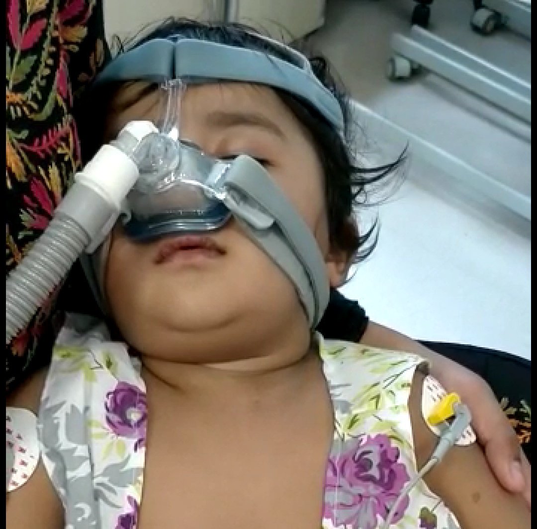 CPCCIndia's tweet photo. Don't Miss the chance to learn the optimum use of NIV In Pediatric ICU.
Learn pearls on use of NIV from experts!

Register soon for NIV workshop on 22nd October 2018 at KIMS, Hyderabad - #IPCCCI2018
@WFPICCS  @ESPNIC_Society @PedCritCareMed @SCCM #PedsICU https://t.co/YA8UNwDbpd