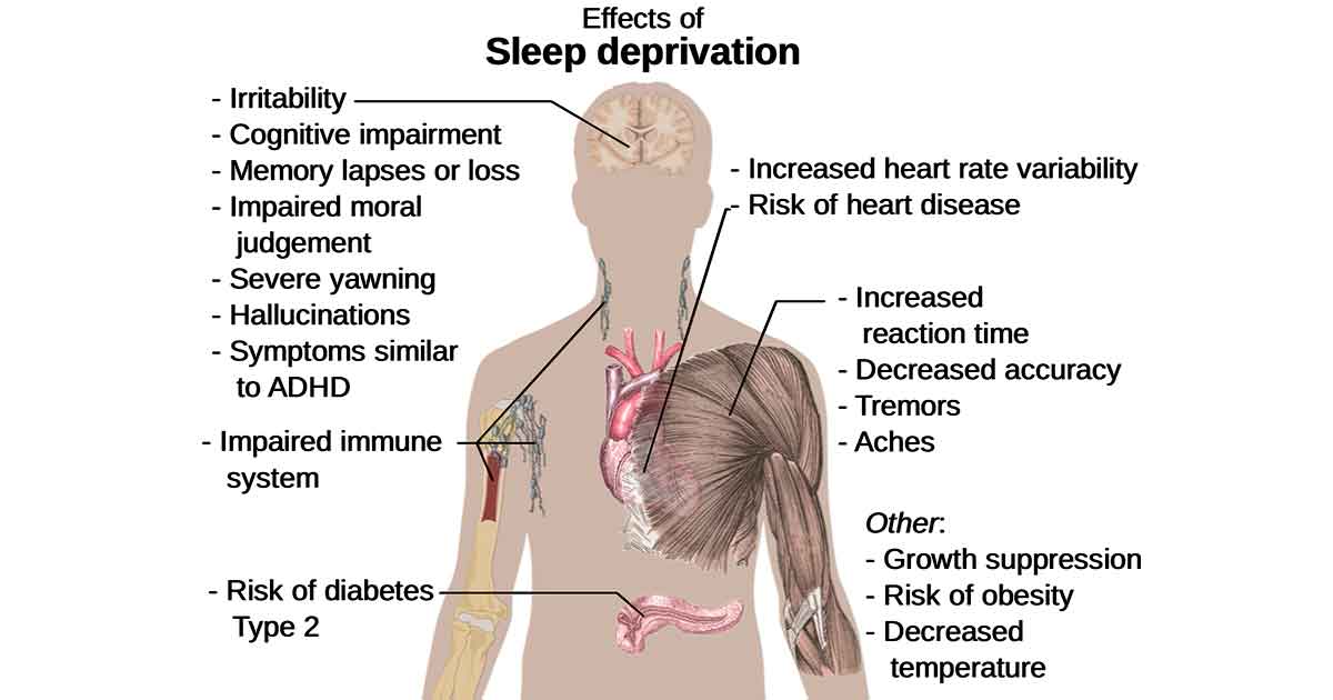 Ubat Muntah Farmasi - Jurupulih k