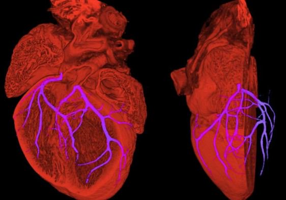 TheBHF's tweet photo. It’s fantastic to see prevention and early detection of heart and circulatory diseases included as a key theme for the @NHSaccelerator call for applications – innovation has a huge potential to save lives #Expo18NHS https://t.co/KExwY6rM9K