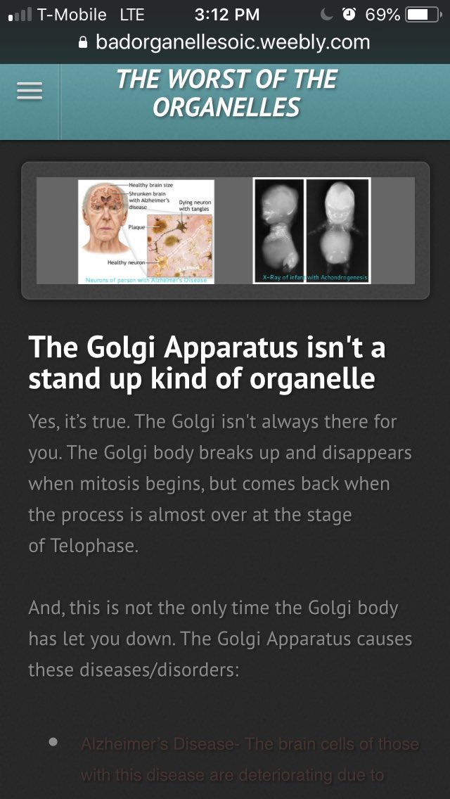 CentriolesRock's tweet photo. If the golgi isn’t gonna stick with us from the beginning then why would we let them control at all? #organellewars #centriole @melbioteach @actualgolgi https://t.co/TaPIVPgG7z