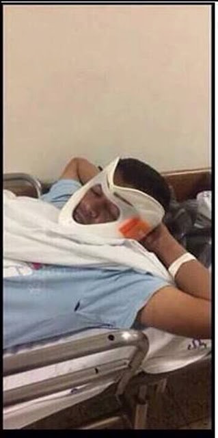 DrLojoRial's tweet photo. Beautiful C-Spine immobilisation examples https://t.co/SqBmmTsLoZ