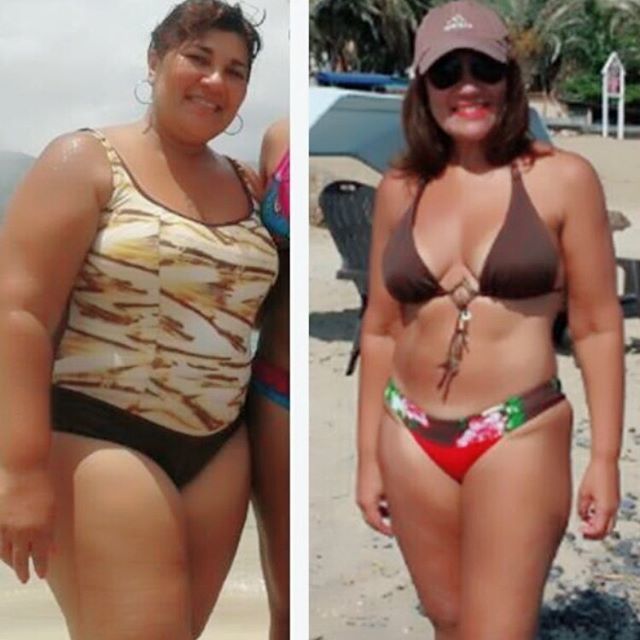 drargenisch's tweet photo. Poco a poco se logran los resultados 💪🏻👍🇻🇪 post Bypass Gástrico. Te felicito @eudenisaquino_  #unigastrodevenezuela #venezuela #anzoategui #lecheria #caracas #colombia #panama #ecuador #españa #peru #miami https://t.co/IbiY9sIZL7 https://t.co/9IjRbyMyZO