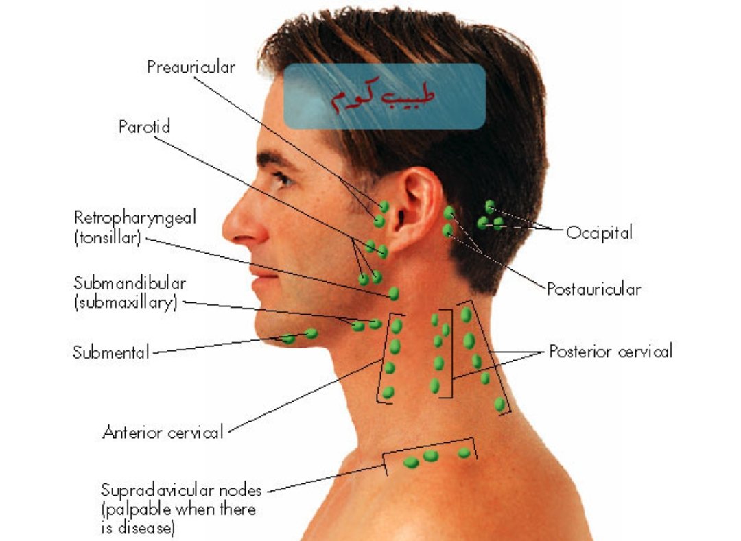 На шее лимфоузлы где расположены у человека. Регионарные шейные лимфоузлы. Воспаленный затылочный лимфоузел. Надключичные лимфоузлы. Лимфоузлы под ухом у человека расположение.