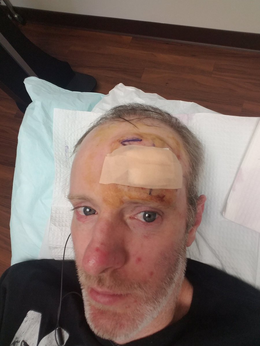 PerplexDamage's tweet photo. This happened Yesterday day while I was listening to @RalphGarman Reporter between scraping ever time Ralph said God Damnit I laughed keep up Great work and now cancer Free. #garmy #tesd https://t.co/GUGMghxOgp
