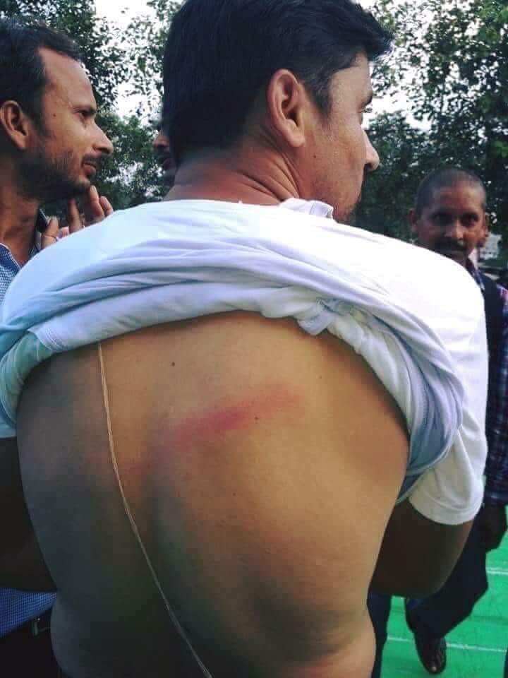 MrDalit's tweet photo. बहुत मारा गया है इनको. जनेऊ के उपर प्रहार की हम कडी निंदा करते हैं. और इन ब्राह्मण महाशय से बिनती करते हैं कि जल्द से जल्द एक भयंकर श्राप देकर इस अत्याचार का बदला ले. #ProtectScStDignity #EndCasteViolance #BahujanUnity #SCSTAct #BharatBandh #FakeBharatBandh #FlopBharatBandh https://t.co/DKVY5Y5kfp