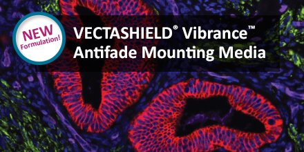 VectorLabsUS's tweet photo. A brilliant solution for fluorescence signal retention!  Introducing VECTASHIELD Vibrance Antifade Mounting Media with or without DAPI counterstain.  For more information: https://t.co/RGztNOCAyF #antifade #immunofluorescence #fluorescence #vectashield #mountingmedia #dapi https://t.co/55srsPnuJj