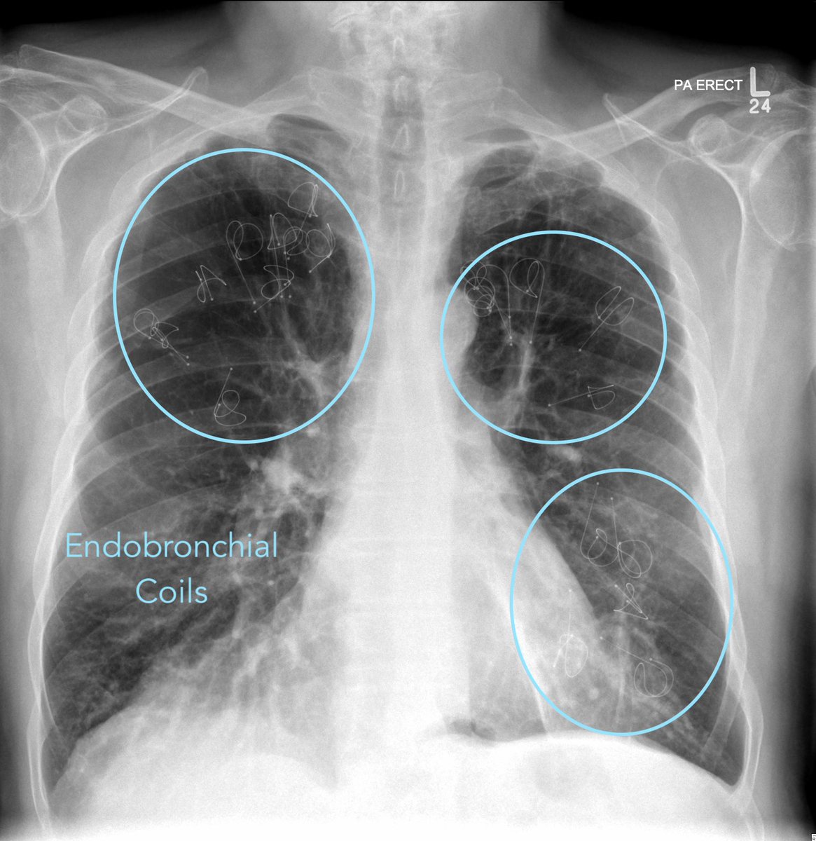 Bath Radiology Education tweet media