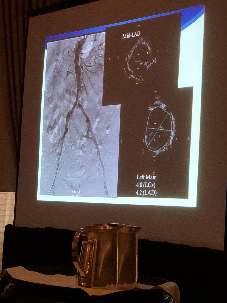 chadialraies's tweet image. Hostile #iliacs requiring mechanical circulatory support - used #PercAx for large bore #DetroitCHIP
