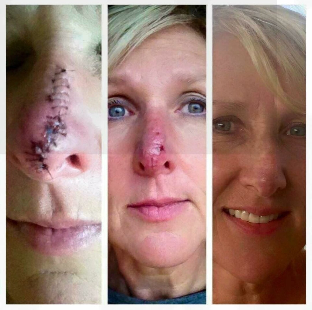 KellyHands7's tweet photo. Rodan+Fields SOOTHE REGIMEN  treats scars too!! AMAZING! 
CONTACT ME! https://t.co/73ddaPTqPR https://t.co/OOvpqwpBFQ