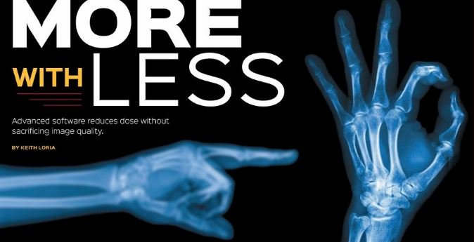 EOSimaging's tweet image. [#PressArticle &amp;amp; #interview of #EOSimaging CEO] @RadiologyToday "More with less - Advanced software reduces dose without sacrificing #imagequality" Learn more about #LowDose #Imaging 
bit.ly/2MWfTsN