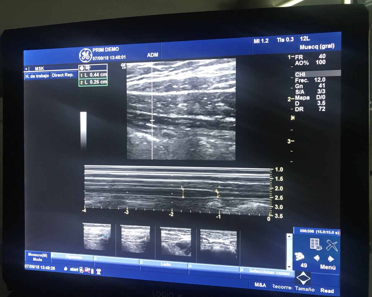 🤔 en nuevas aplicaciones para el modo M.... #ecografía #Ilovethisgame