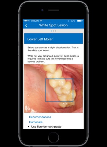 VamseeK5's tweet image. On-Demand Oral Dental Care via Smart Phone App - Looking forward for more DentalTech.

Toothpic Launches in the US to Deliver Expert Dental Advice Via Smart Phone App
#ToothTech #Toothpic #ondemand #Teledentistry #Dental #App #smartphone 
globenewswire.com/news-release/2…