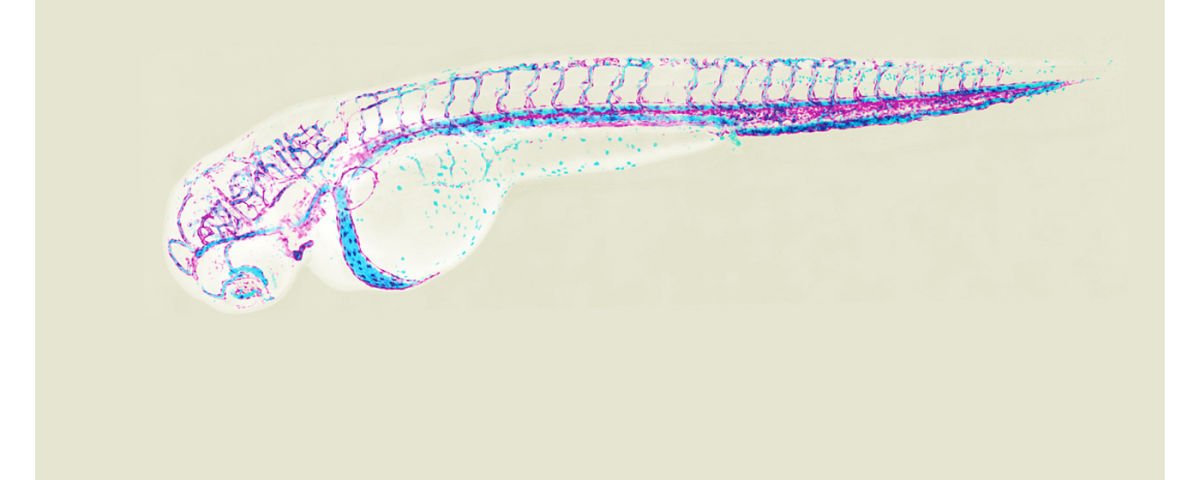 alliancegenome's tweet image. transparent #zebrafish #embryos undergoing #vascularization reveal that #endothelial cells lining inside of #blood vessels extend out of existing vessels to form new capillaries, while remaining glued to each other, preventing hemorrhage the-scientist.com/image-of-the-d… #modelOrganism