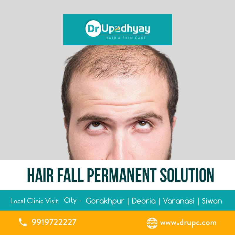 dr_clinics's tweet photo. What is the best treatment for hair loss? Dr. Upadhyay Clinics
#HairFallTreatment #HairFall #DrUpadhyay #DrUpadhyayClinics #hairloss #hair #hairproblem #hairLosstreatmentinsiwan #hairFalltreatmentDeoria
Call - 9919722227, 9113467154
Book your appointment - https://t.co/rTZPQ6eKW5 https://t.co/5hTGjqvfOc