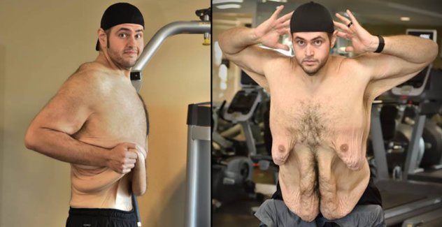 viralbigo's tweet photo. Engagement Inspired This Obese Man to Lose 317 Pound #weightlossjournal #weightlossjourney #weightlosssurgery https://t.co/ymZsEvPb7X https://t.co/mgUSnTxYhh