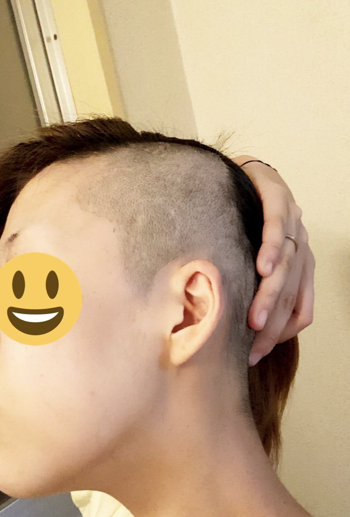 みー V Twitter 嫁の髪の毛減ってたら気がつくかチャレンジは何事もなくおわりました 虎刈りや みー V Twitter 嫁の髪の毛減ってたら気がつくかチャレンジは何事もなくおわりました 虎刈りや