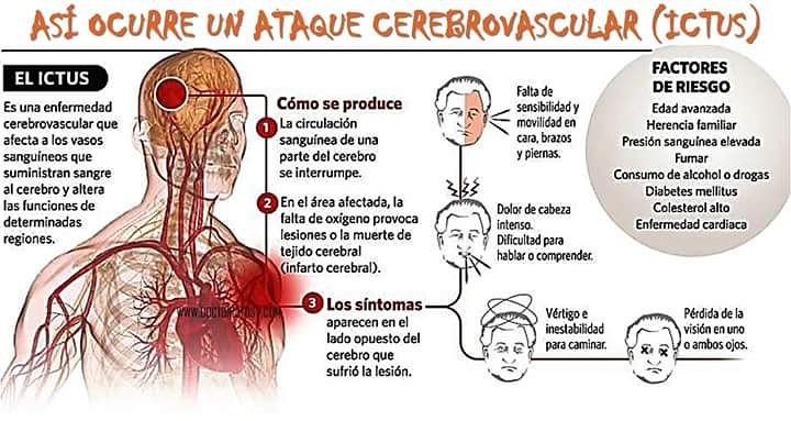 fucacsantafe's tweet photo. Para nosotros #ConocerEsPrevenir

#FUCAC  #ACV https://t.co/f3V0OGZxQ9