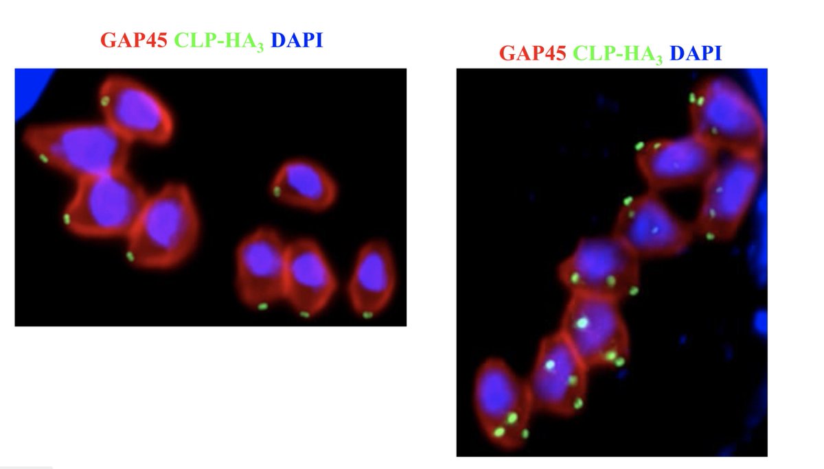 veupathdb's tweet image. #usercomments are coming in… check out this one showing conoid localization of the hypothetical gene TGME49_266630 in #ToxoDB #crowdsourcing toxodb.org/toxo/app/recor…