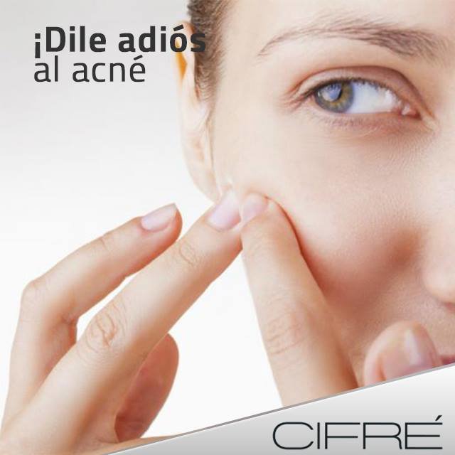 Dile adiós al acné, con nuestro Tratamiento de acné con láser. No lo piense más.  #belleza #Nutrición #Estética #Beauty #SkinCare #Piel #CuidadoDeLaPiel #ClinicaCifre #Cifré #Cifre #Estetica #ACNE