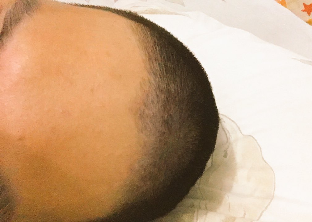 davinandikac's tweet image. I ask the barber to cut 2cms but now I look like an Easter Egg 😥 ini mah 0.5cm fak