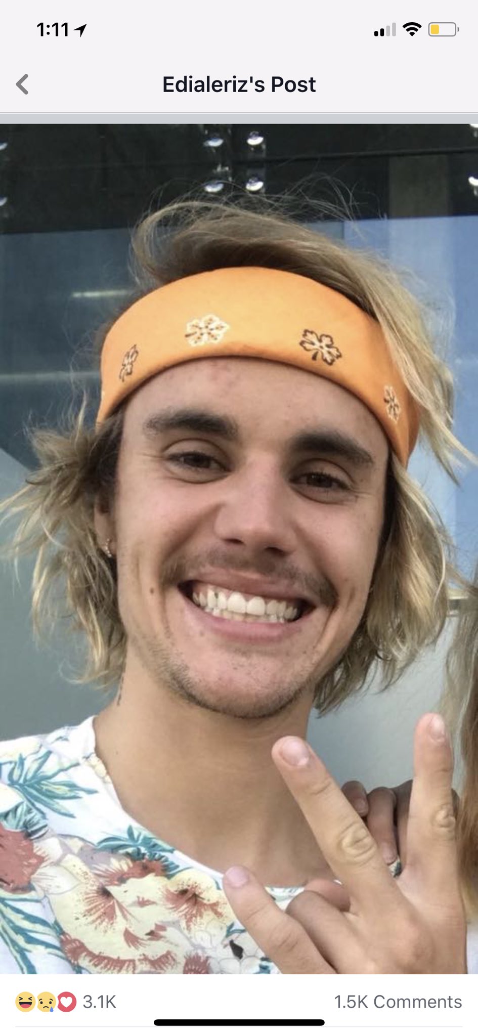 Ellie Puckett Garza ♒️🪬 on Twitter "Justin Bieber’s teeth are rotting