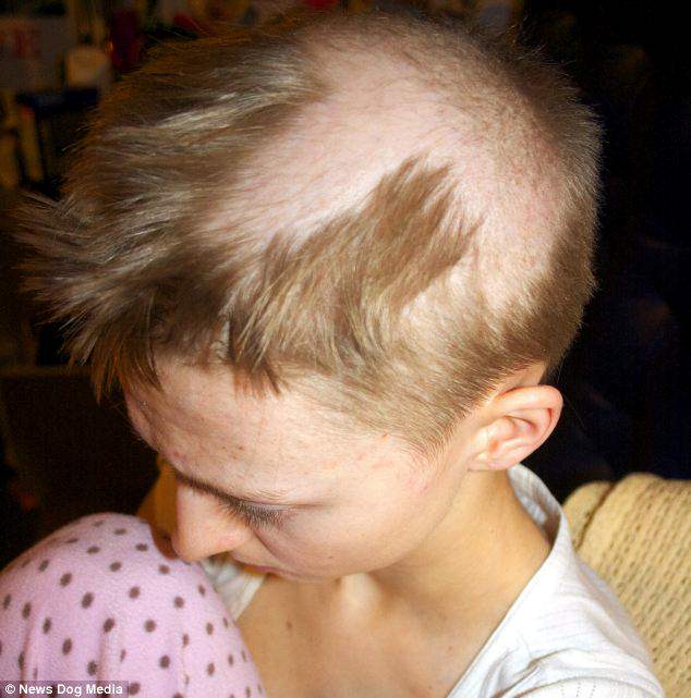 ScalpDoctor's tweet photo. #RadioShow 9/12/18 at 11am CST with host @ScalpDoctor discussing about alopecia with affects 90 million Americans, hair care, scalp care, &amp; our 5th alopecia scholarships on  @DFWiRadio #Alopecia #scalpdisorders https://t.co/3bu1iudyNb