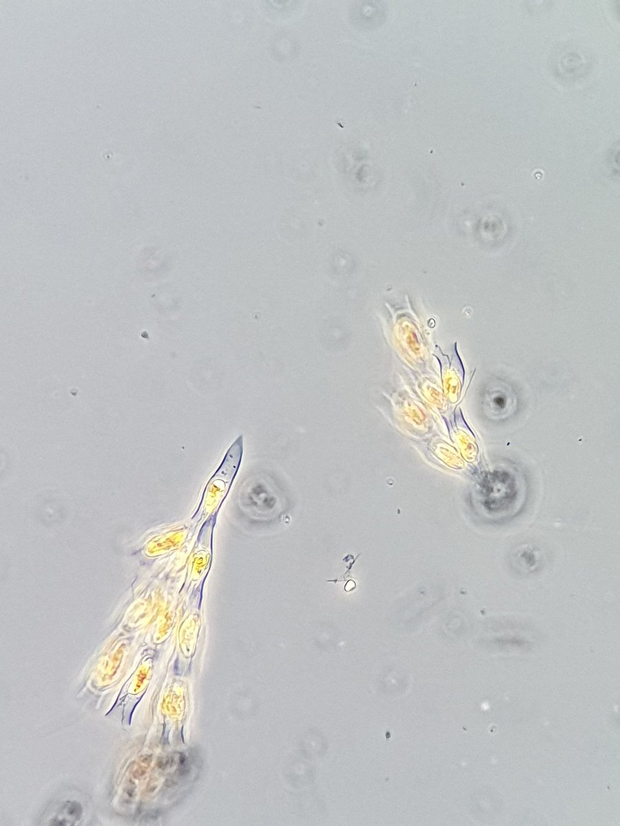 Things that #algae look like 1: Dinobryon colonies (#Chrysophyte) remind me of #peacock tails.

The cell between the Dinobryon is Chrysochromulina (#Haptophyte).

#microalgae #phytoplankton  #Microscopy #Australia #AquaticAdventures #idtellyouthelocationbutthenidhavetokillyou