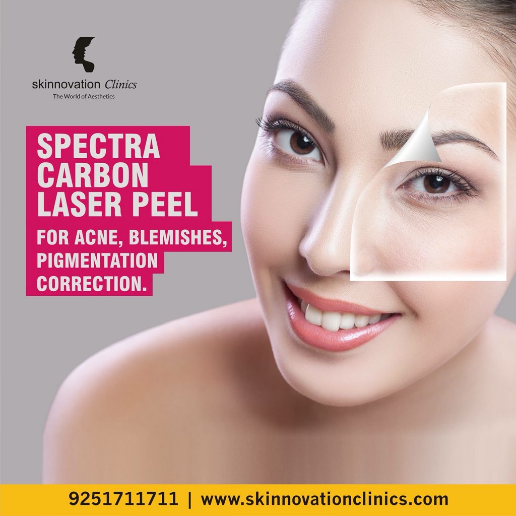 SkinnovationC's tweet photo. Acne problem no more, a pain free solution. Spectra Carbon Laser Peel is now available at Skinnovation Clinics.
Book an appointment : 9251711711 | https://t.co/25Sybp8syJ
#Acne #SpectraXT #LaserTreatment #CarbonPeel #HollywoodPeel #SkinnovationClinics #Dermatology https://t.co/dE9quXtWAE