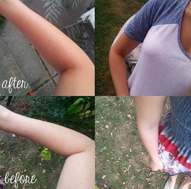 NutanUk's tweet photo. ✔️Less Sun Exposure
✔️ Natural, Healthy-Looking Tan
✔️Easy to use
✔️A True Alternative to Painful Tanning Injections
✔️Affordable
☀️☀️Check the results 🔛 https://t.co/ur6BZ7Et51
#tanning #tanningtips #tanningtime #tanningday #tanningskincare #tan #tanned #skincare https://t.co/u7zhwXi9Ho