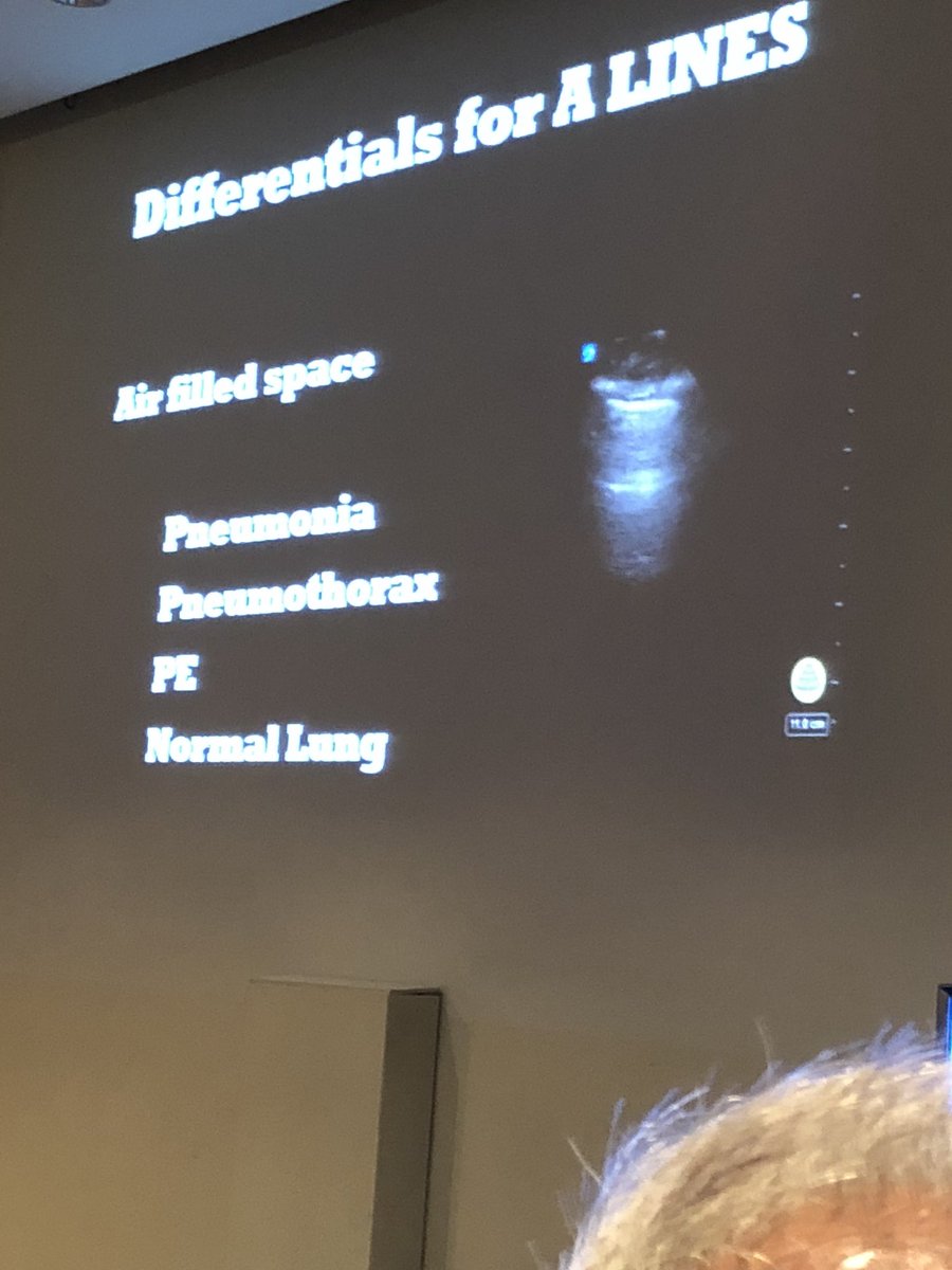 draroramohit's tweet photo. How to assess the 65M presenting with Acute SOB with #POCUS @POCUSClub #A-lines #B-lines #LungPoint #LungPulse #M-mode @EuropSocEM #EuSEM2018 https://t.co/6KtuK3Ljqq