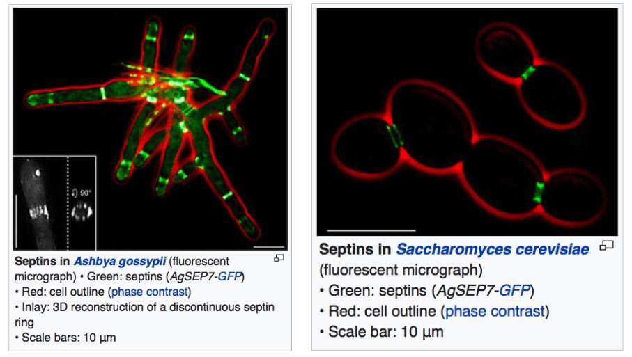 ensembl's tweet photo. Today is the 10th of September - so our #GeneOfTheWeek is SEPT10 (clearly lacking #MondayMotivation here at Ensembl HQ...!)
SEPT stands for 'septin'. The protein product of septins make some neat structures that form barriers to diffusion within cells.
https://t.co/TYuhLuUWuO https://t.co/e7JLgbCLhO