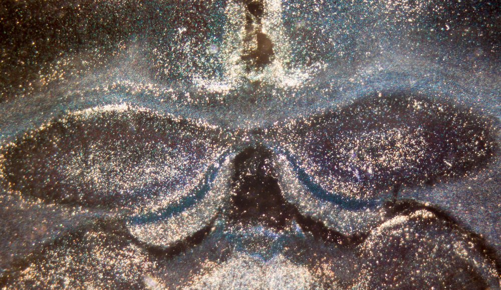 bruker's tweet image. #ImagingTechniques for assessing the effects of cerebral #ischaemia in vivo okt.to/WXiXLr #preclinicalimaging #invivoimaging