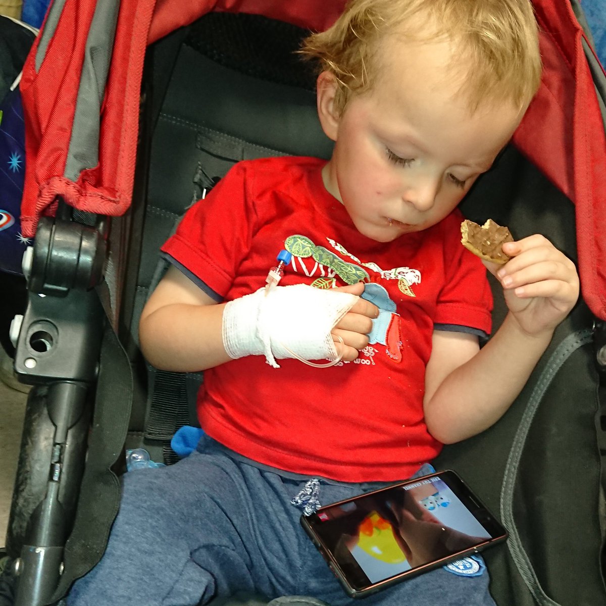 ByMumOnFire's tweet photo. Stage 1- normal cannula in and coamoxiclav given in A&E to get on top of chest infection whilst we wait for a bed and hopefully his line fitted in theatre tomorrow under sedation.
#bronchiectasis #asthma #toddlerlife #mumlife #respiratorydisease #lungwarrior #mywarrior https://t.co/gajpKKsP0b