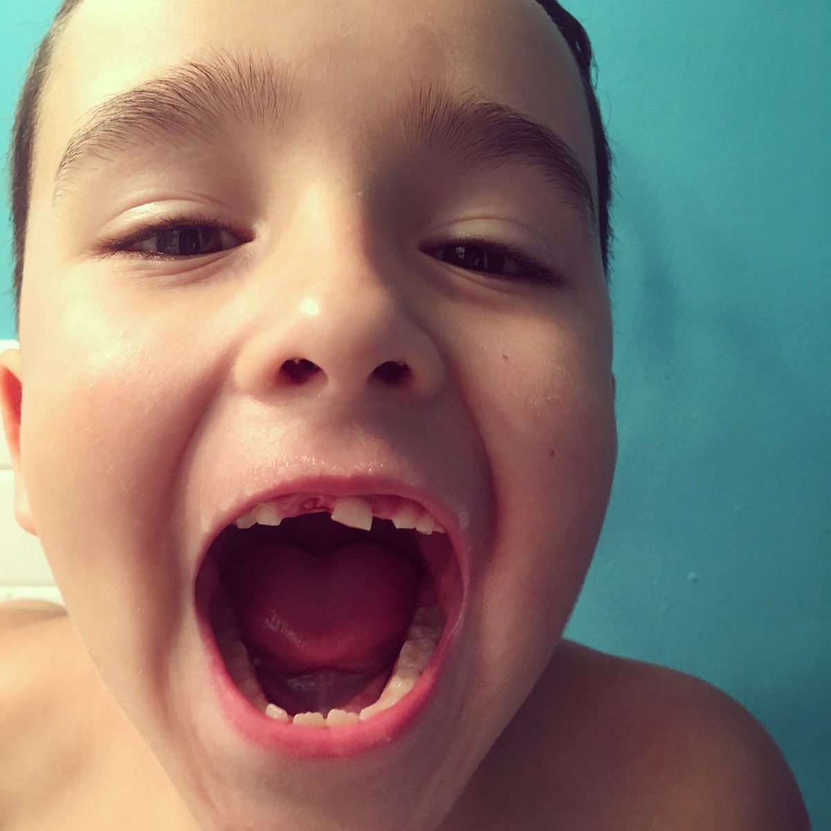 kelly5375's tweet image. 🌟 Hey Tooth Fairy! Stop at our house tonight!! #toothfairy #joshiesworld #losttooth #6yearsold #1stgrade #theothertoothisloosetoo #toothless #hesstillcutetho #mybigboy #mybabycakes #myson #bestkidsever #lovehim