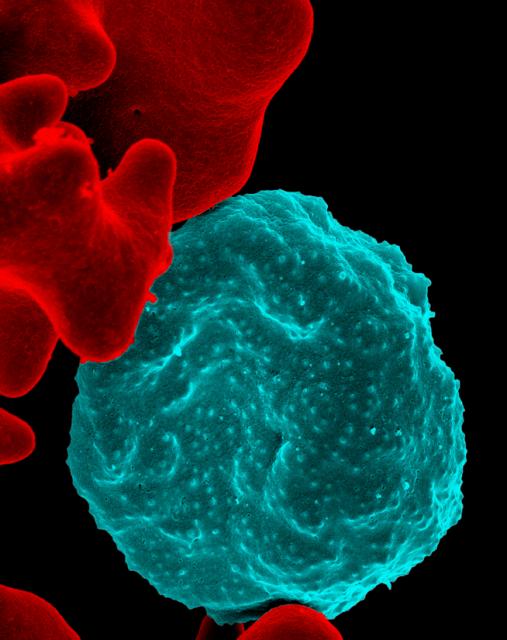 A red blood cell, colorized blue, infected with malaria parasites, which appear as small dots on the cell's surface.