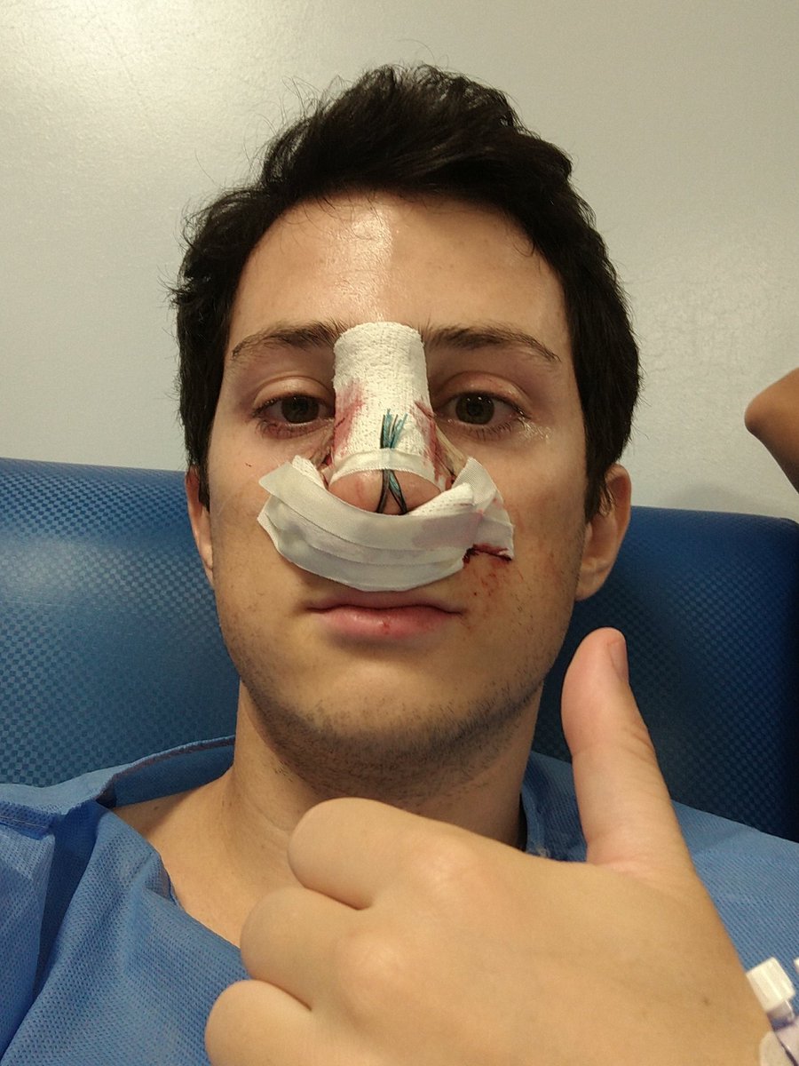 WithZack's tweet photo. Chicos, todo bien la operación, duele como un demonio pero estamos bien.
Me dijo el médico que no entendía como no me operé antes, que literalmente no respiraba por la nariz. https://t.co/bFpgxq5iq6