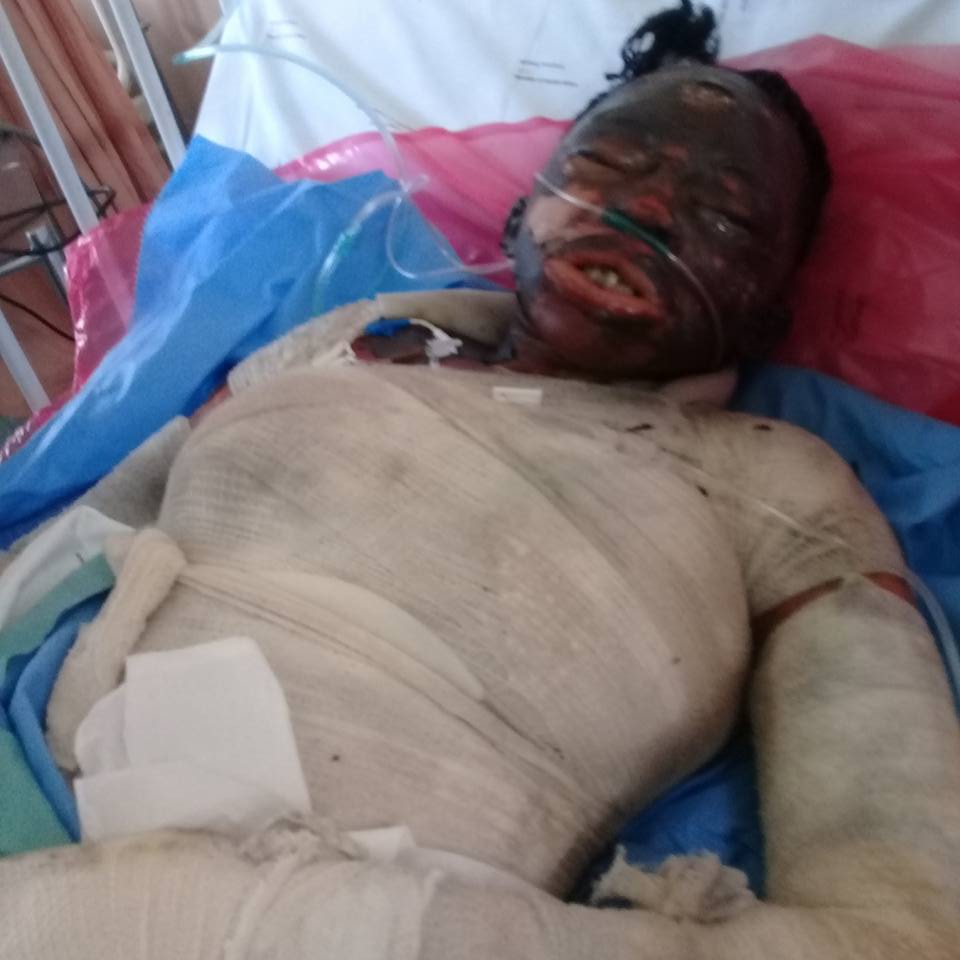 Ke_gopcha's tweet photo. This lady right here is my little sister,Smangele and a few day ago she was admitted to hospital because this coward guy in the picture Nkosana sipho prince mthombeni poured paraffin on her and set her on fire...today at 2am Smangele Pearl kholeka mnisi Mahlangu died in hospital https://t.co/19BO5QdjKx