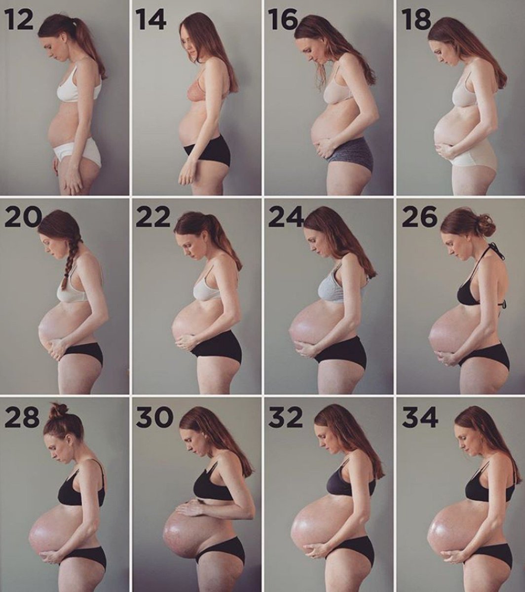 Grávida de trigêmeos registra em fotos evolução da barriga glo.bo/2N3y5Av #G1