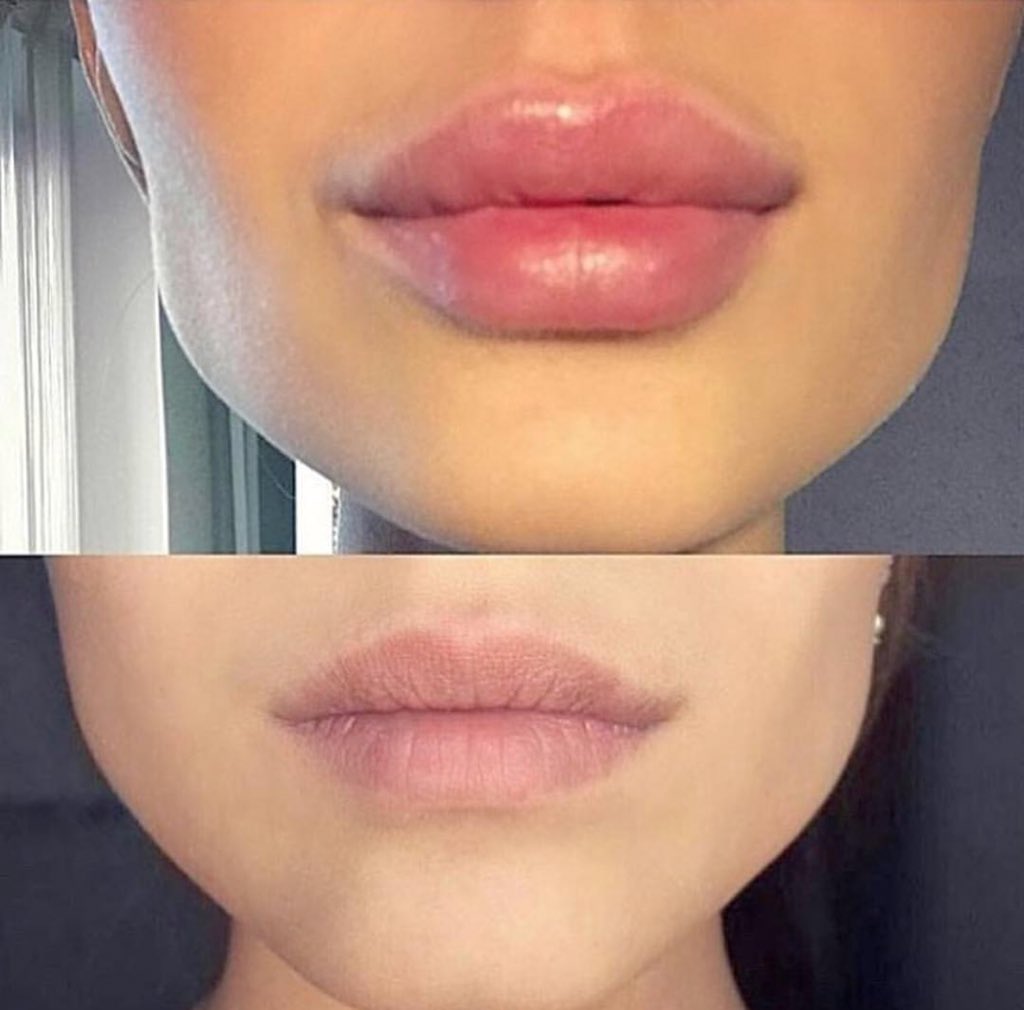 Si j'avais une bouche comme ca: j'y toucherai pas! Elle etait tellement belle. Et vous?